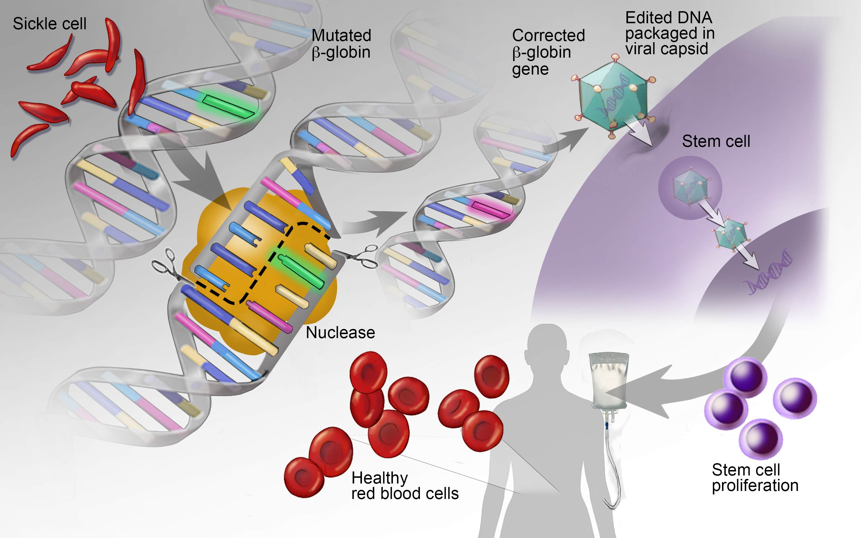 sickle-cell-gene-fixes-and-health-justice-the-chief-organizer-blog